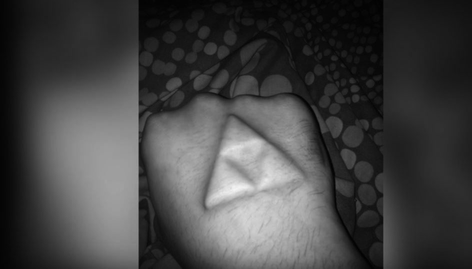 به‌وێنه‌.. مه‌ترسيدارترين نه‌شته‌رگه‌رييه‌كان له‌ جيهاندا ببينه‌